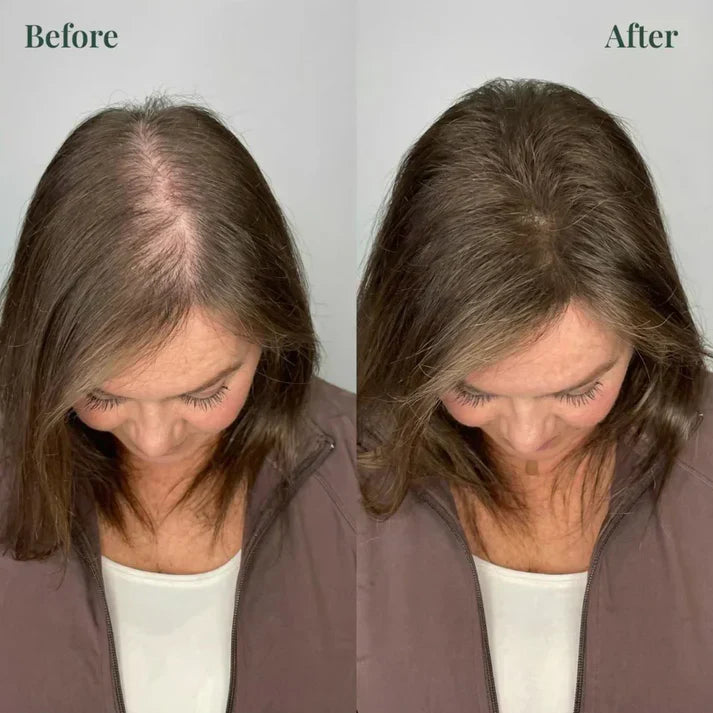 Kerarose Rosemary Shampoo For Hair Growth